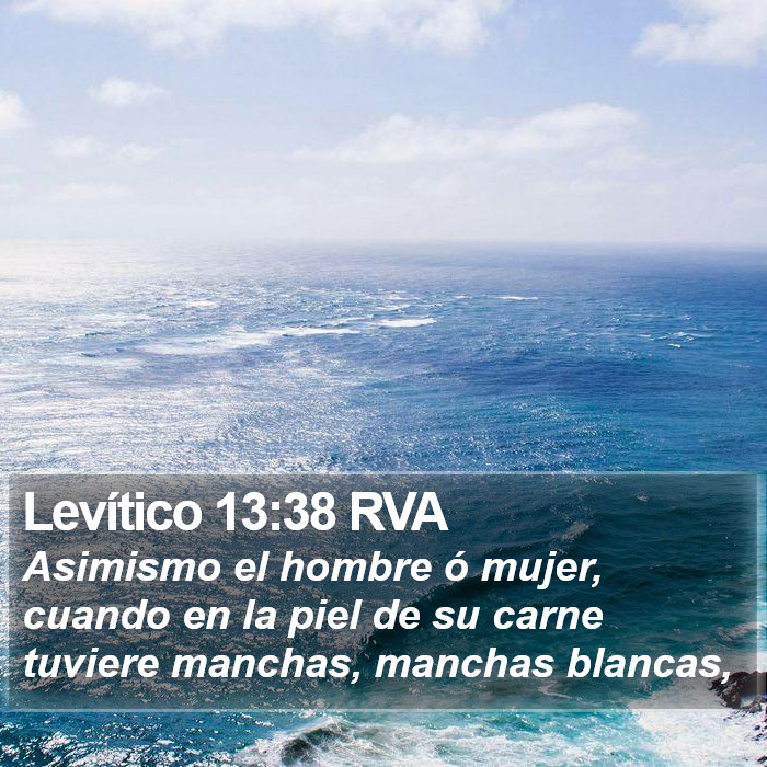 Levítico 13:38 RVA Bible Study