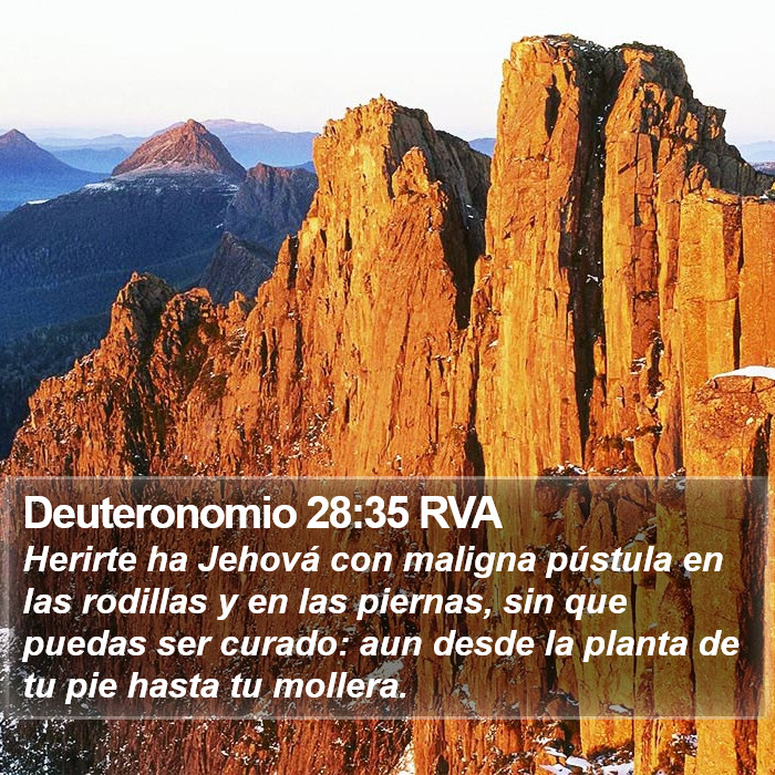 Deuteronomio 28:35 RVA Bible Study