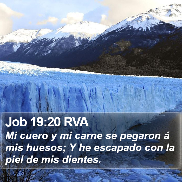 Job 19:20 RVA Bible Study